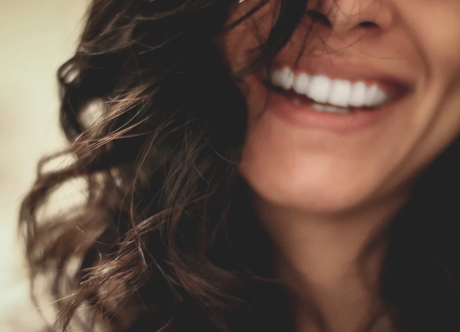 Sbiancamento Dentale